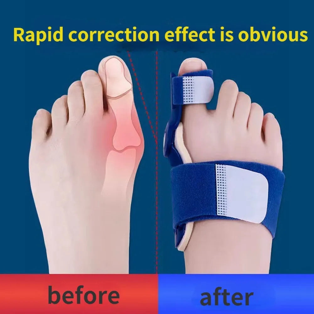 Bunion Relief Toe Splint