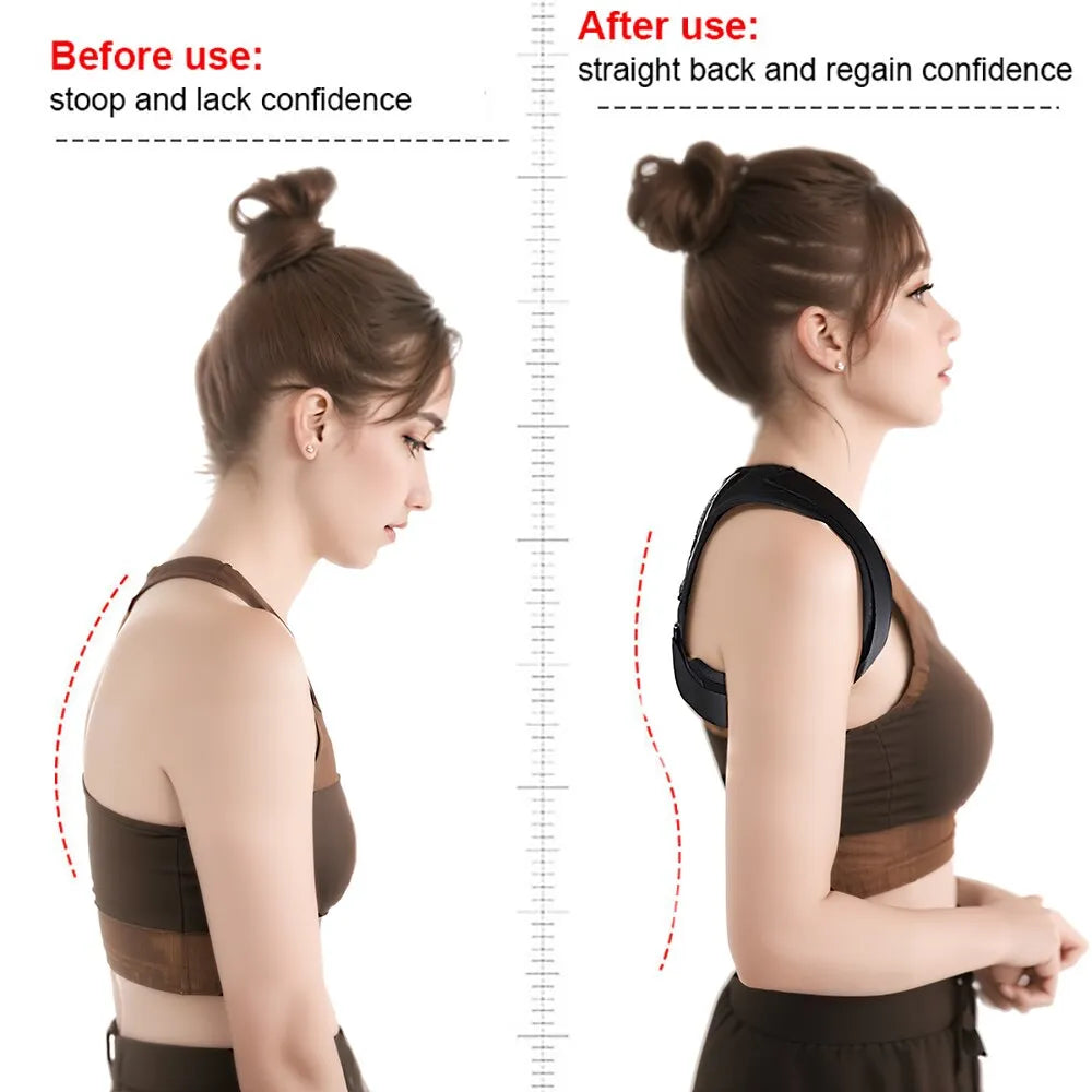 Adjustable Posture Corrector